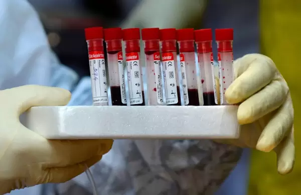 Coagulación sanguínea y COVID-19: ¿Qué tan grave es la relacióñ