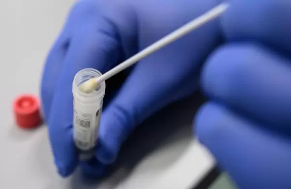 Cmo funciona la inmunidad al coronavirus: es posible el doble contagi?