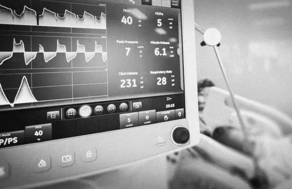 Petrleo o respiradores: adnde debe ir el estmulo fiscal durante una pandemia