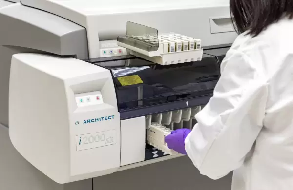 Abbott anuncia la aprobación de su prueba de anticuerpos COVID-19 en Argentina