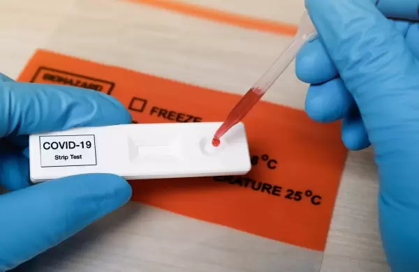 Estudio argentino revela que el 95% de los pacientes de Coronavirus desarrollaron anticuerpos a los 45 días