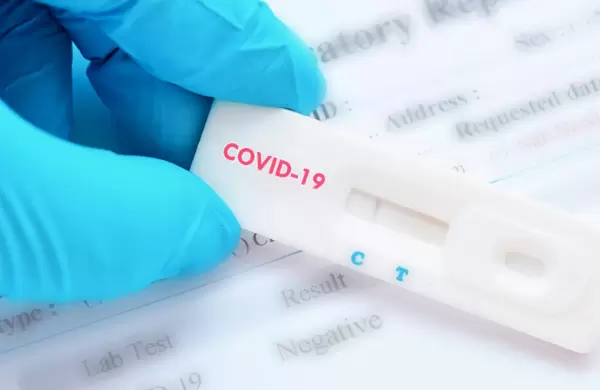 Estudio revela qué síntoma indicaría que se tiene Covid aunque esté vacunado