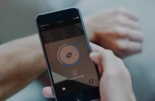 As es la alianza de Roche- Posay con esta app que detecta casos sospechosos de cncer de piel