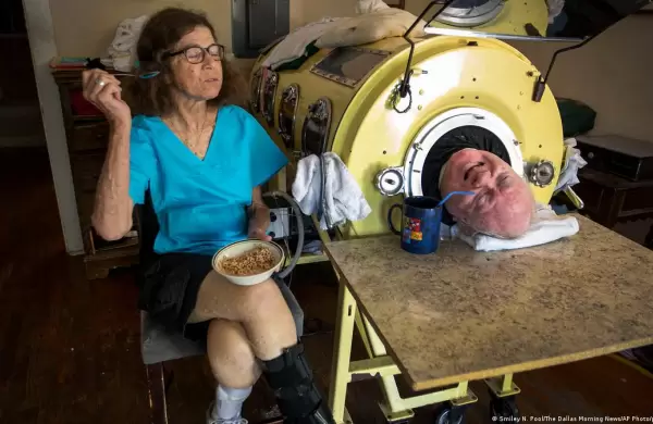 Adiós a Paul Alexander, el hombre que vivió 78 años dentro de un "pulmón de acero" y llegó a ser abogado y escritor