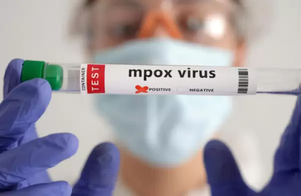 Cul es el vnculo oculto que conecta Mpox, COVID-19 y VIH/SIDA y que es importante tomar conciencia ante los nuevos casos epidemiolgicos