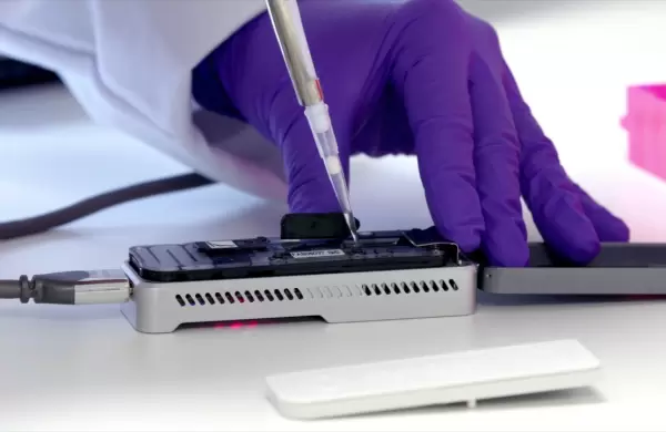 Cmo funciona? As es el sistema creado para detectar un riesgo de pandemia