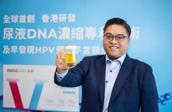 Esta startup recaudó US$34 millones para pruebas de orina que ayudan a diagnosticar el cáncer